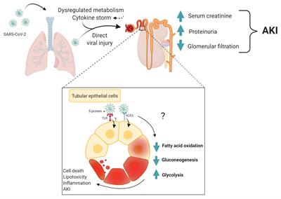 Metabolic Alterations in SARS-CoV-2 Infection and Its Implication in Kidney Dysfunction